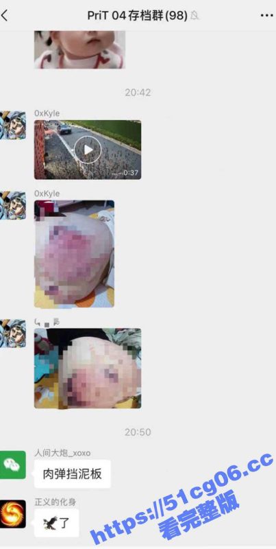 痛痛痛！小姐姐坐摩托车不小心一屁股坐到后轮胎上 蜜桃臀被后车轮磨得满目疮痍 差点烂了屁股-51吃瓜网